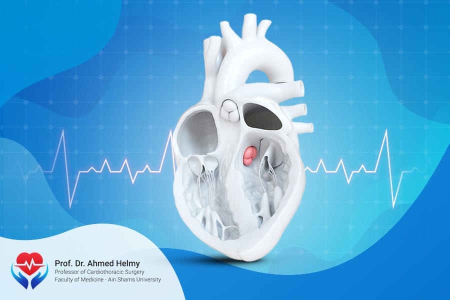 صمام القلب الأورطي