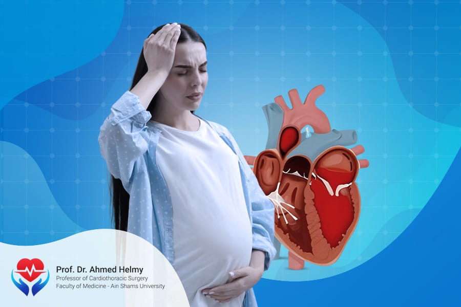 ارتخاء الصمام الميترالي والولادة ارتخاء الصمام الميترالي والولادة